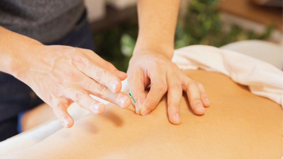 鍼治療
